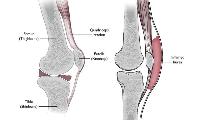 Knee Joints