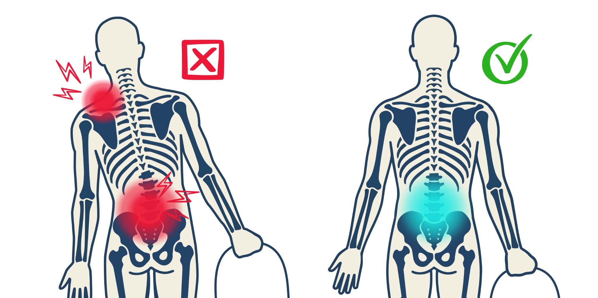 Straining to lift heavy things with improper posture can cause back and shoulder strain injuries. Lifting/carrying with an upright posture is best practice.