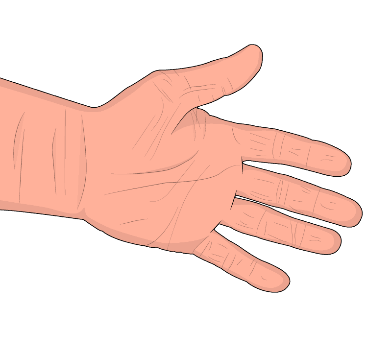 Human hand before Hand Arm Vibration Syndrome