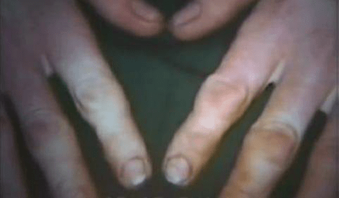 Hand Arm Vibration symptoms to tissue